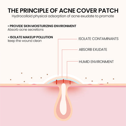 Pimple Patches Deep Clean Gentle Non-Irritating Facial Treatment Acne Removal Waterproof Beauty Skincare Concealer Pimple Marks